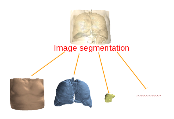 Lung CT image segmentation