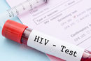 HIV: una foto simbolo
