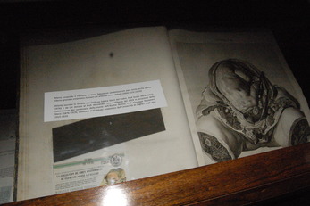 L'Atlante di Anatomia donato dalla nipote di Giuseppe Sterzi, Sabina, al professor Riva e da questi ceduto all'Ateneo