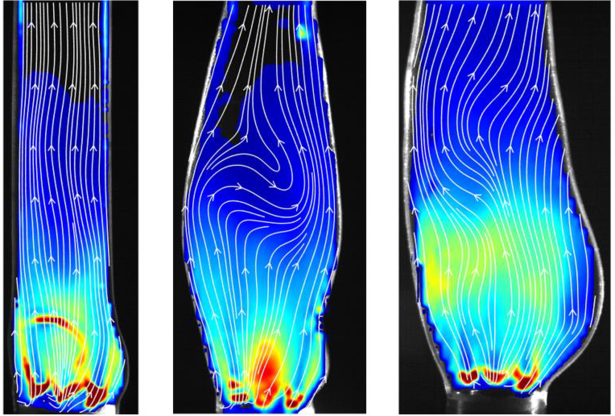 La figura riproduce mappe di energia cinetica turbolenta in tre modelli di radice aortica