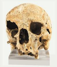 Cranio di San Benedetto di Iglesias con dente canino incluso