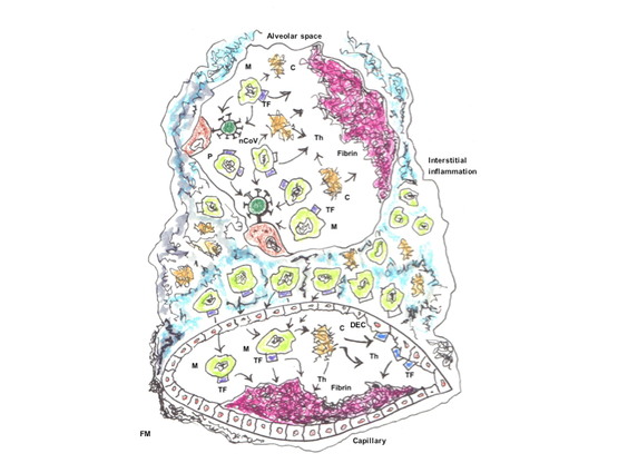 La ricerca degli specialisti dell'ateneo di Cagliari e la pubblicazione sul Journal of throbosis and haemostasis