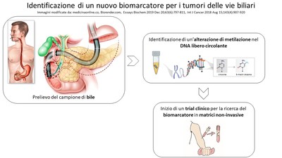 L'illustrazione della scoperta del bio-marcatore per tumori delle vie biliari