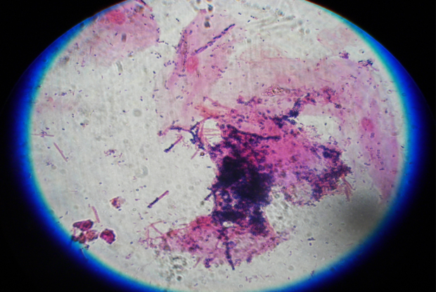 La foto al microscopio di un campione di biofilm linguale e microbiota (foto Laboratorio biologia molecolare