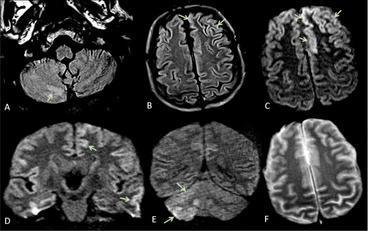 Il cervello, questo (per molti aspetti) sconosciuto (archivio unica.it)