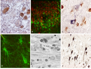 neuroanatomia