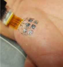 La "Matrice nano eminenza tenar"